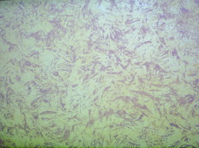 gewickelt auf getupfter Tapete